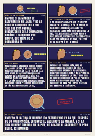 La tiña